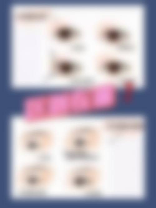 临床实例分享