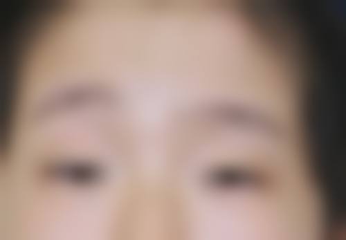 医生资质介绍:鹿秀兰+核心项目