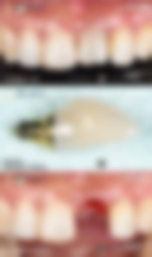 临床实例分享
