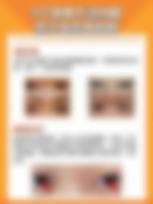 擅长项目详解