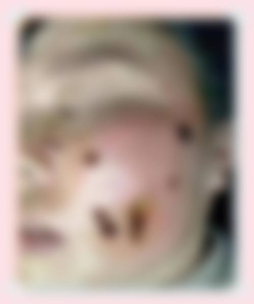 医生资质介绍:陈果医生擅长项目详解