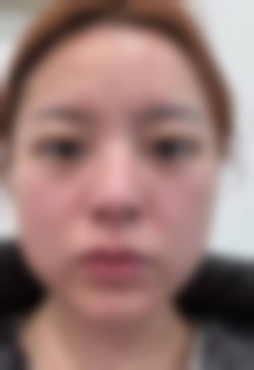 FAQ北京伊莎雅轩医疗美容医院金玉竹