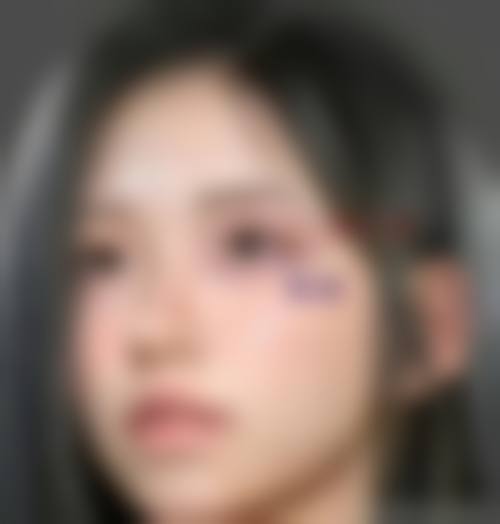 临床实例分享