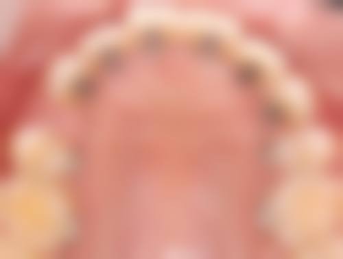 服务流程与优惠活动详情