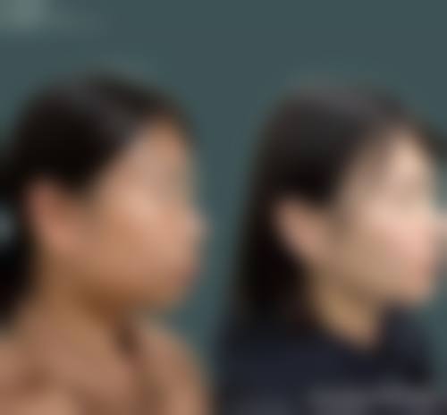 常见问题解答与预约指南