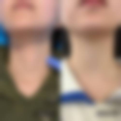 擅长项目详解杭州新友好医疗美容门诊部袁利森