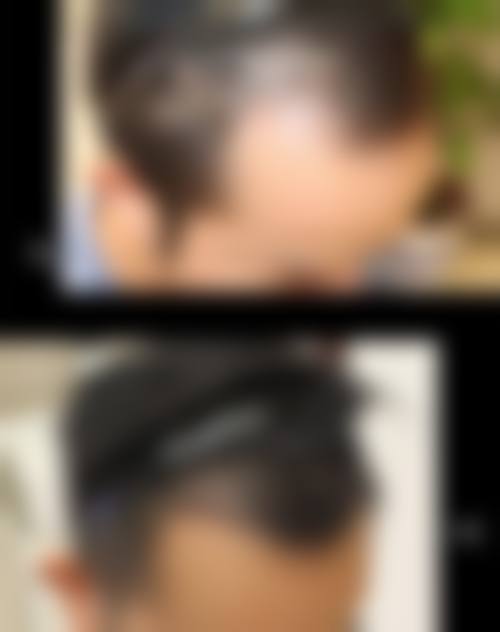 热门项目价格参考与市场优惠解析