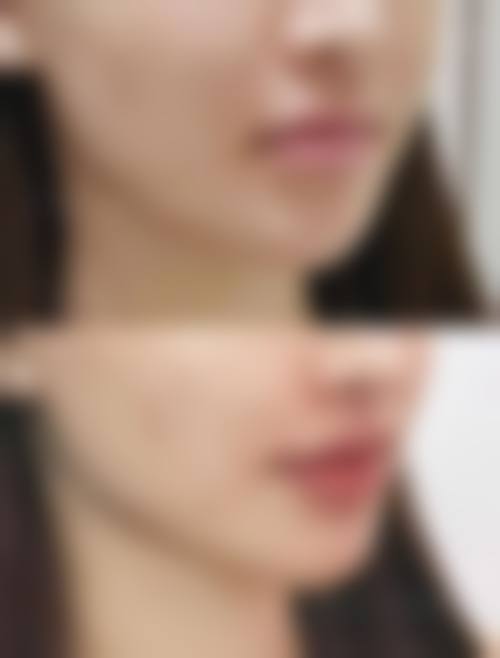 总结与预约号召