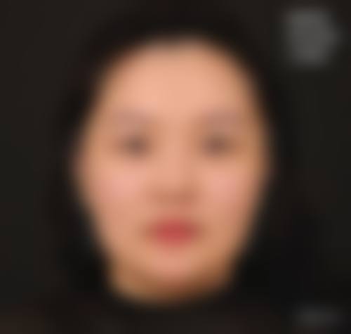FAQ杭州新友好医疗美容门诊部袁利森