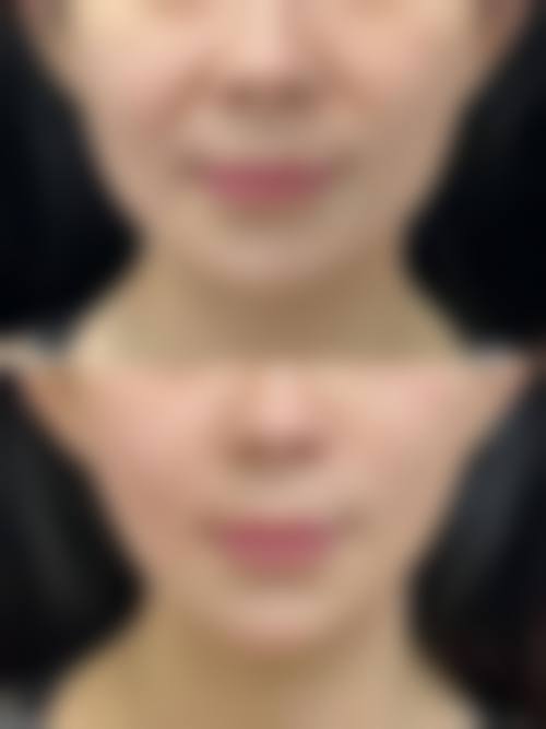 便捷预约流程与售后服务保护