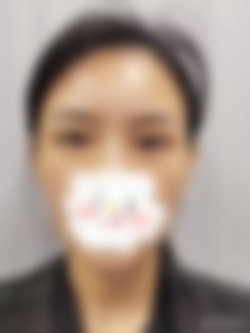 医生资质介绍广州睛亮眼科门诊部叶天才
