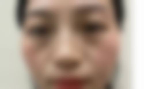 预约优惠活动