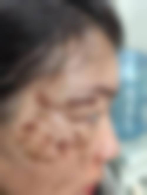 患者真实评价