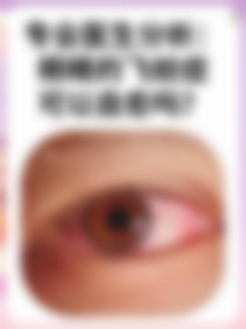 FAQ:常见疑问解答