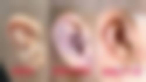 患者真实评价:口碑积累源于信任
