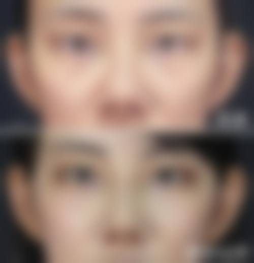 临床实例分享:真实反馈见证疗效
