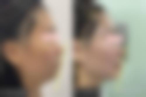 FAQ:常见问题解答