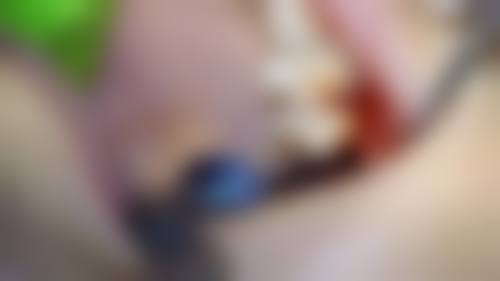 临床实例分享