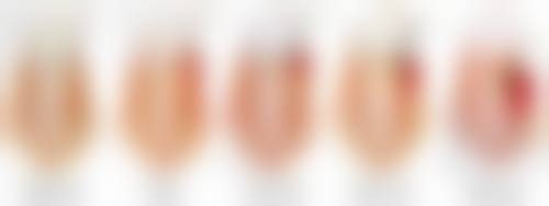 预约优惠活动:专属补贴助力健康