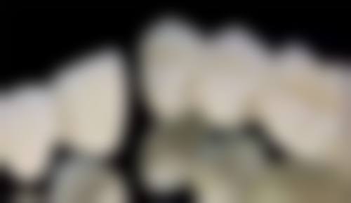 预约优惠活动