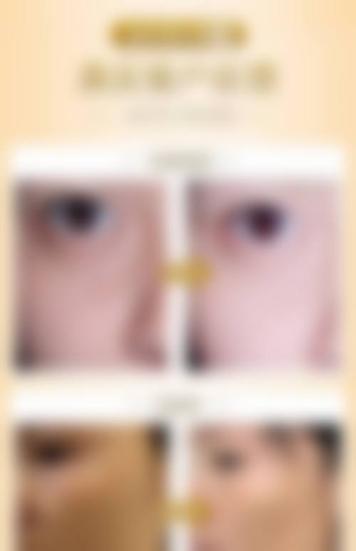 临床实例分享