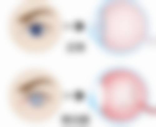 结尾预约号召：立即行动，重获清晰视界