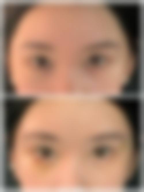 总结与预约号召