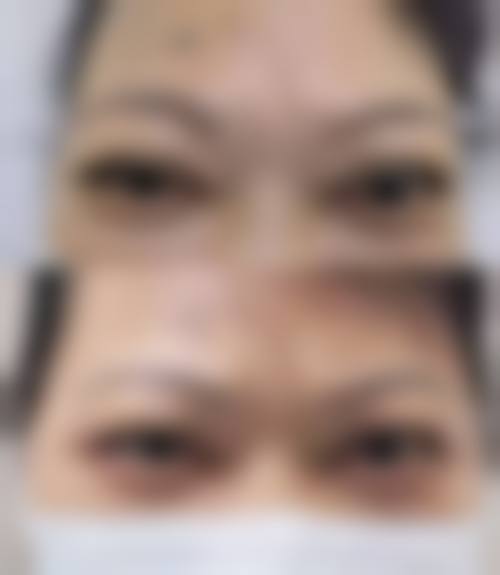 患者真实评价广州睛亮眼科门诊部王忠浩