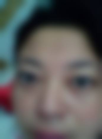 预约优惠活动广州睛亮眼科门诊部王忠浩
