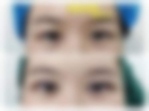 擅长项目详解:蔡景宁医生擅长什么?