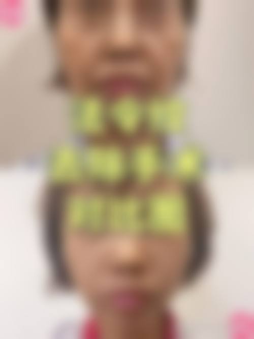 临床实例分享