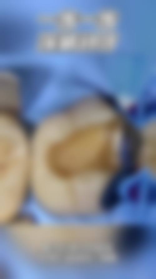 价格透明与优惠活动详情