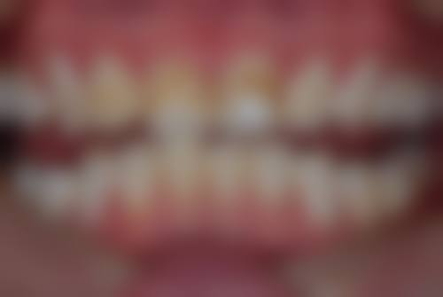 患者真实评价惠州精英惠口腔门诊部赖文婷
