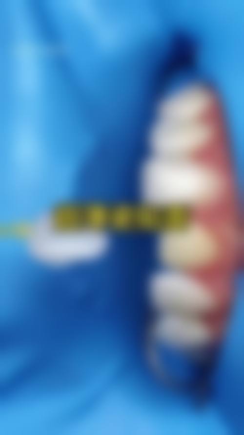 临床实例分享:治疗成效能达到预期吗?