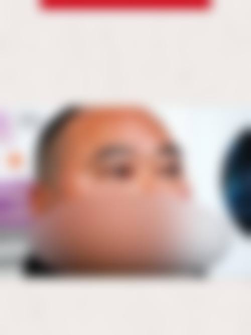 临床实例分享