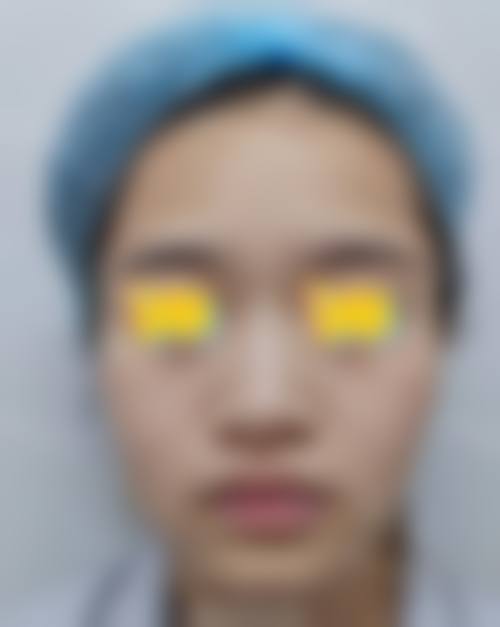 优惠活动详情与价值