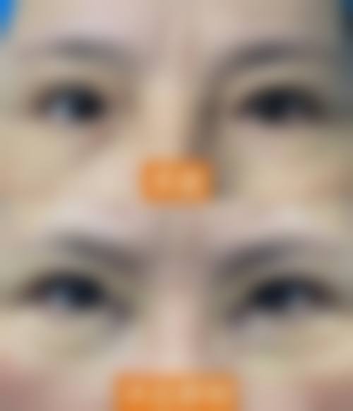 总结与预约建议