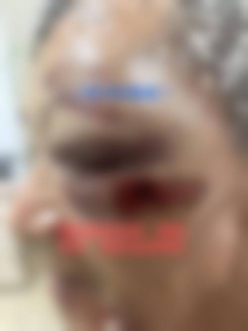 擅长项目详解:朱旭果医生主要看什么病?