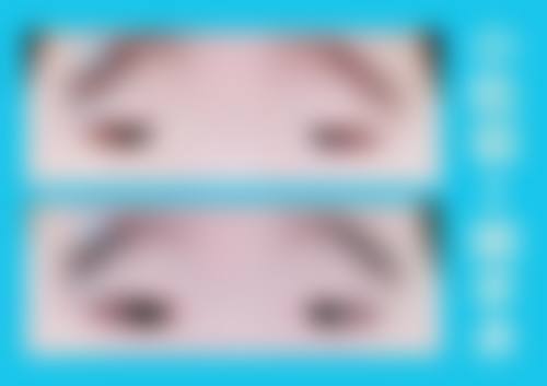 结尾预约号召:立即行动,守护视力