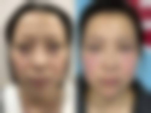 价格透明与优惠活动详情