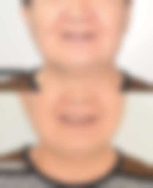 参考价格体系:透明消费与性价比分析