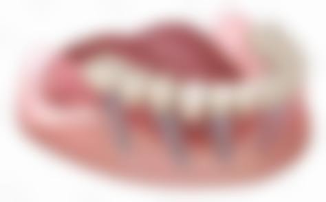 预约优惠活动
