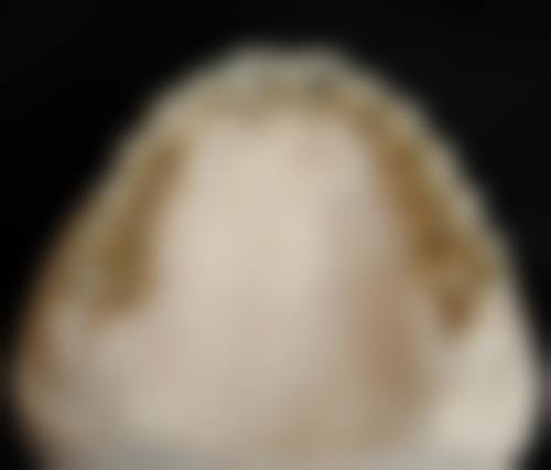 总结与预约号召