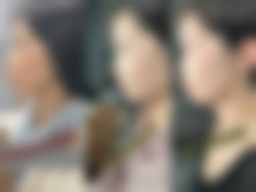 临床实例分享