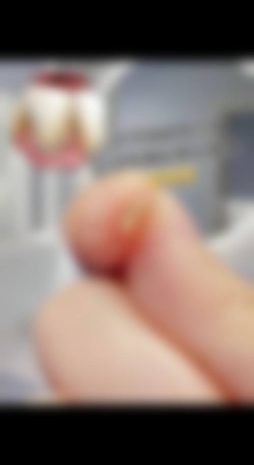擅长项目详解