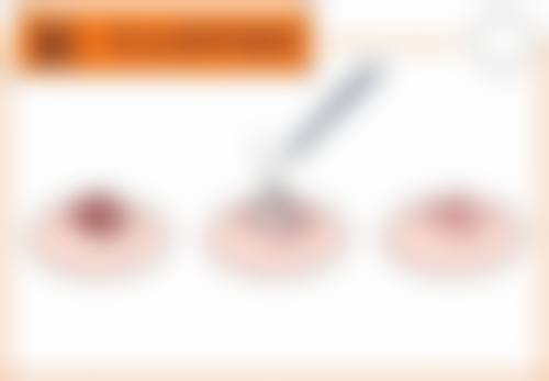 骨干医生团队与技术优势