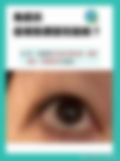 常见问题解答