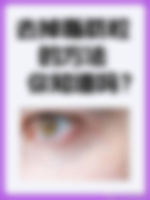 预约优惠活动：限时补贴不容错过