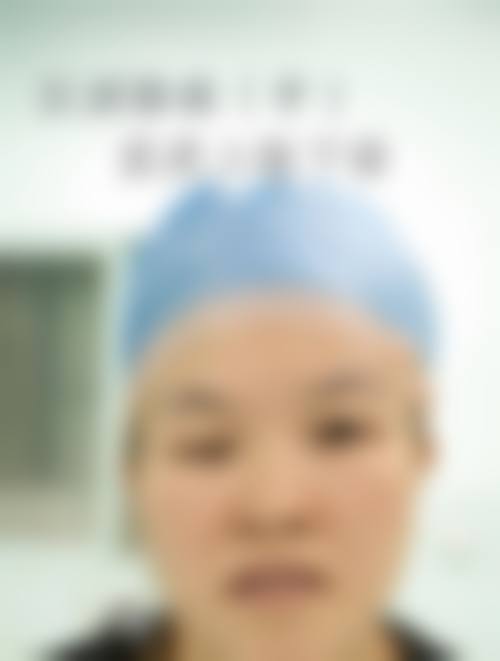 临床实例分享:真实反馈见证疗效● 典型斜弱视修复故事● 眼底病早期干预成果